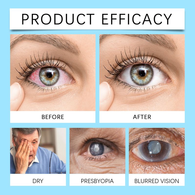 Ximonth Eye Care Solution Soothes Eye Discomfort, Moisturizes And Comforts Eyes With A Gentle Formula_voghion.com