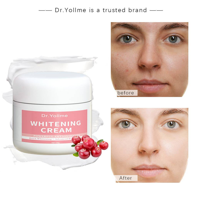 Dr.Yollme Body Whitening Instant Glow Cream – Leichte, feuchtigkeitsspendende und natürlich aussehende Formel für aufhellende Haut_voghion.com