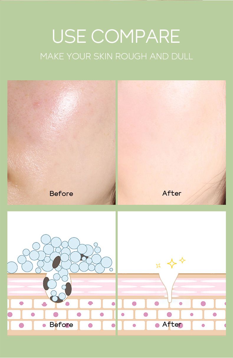 Mască de nămol cu ceai verde Fen Yi 100g Apă hidratantă și răcoritoare care rafinează porii_voghion.com