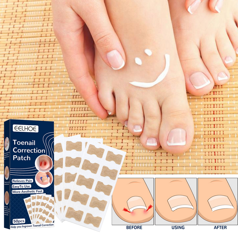 EELHOE tånagelkorrigeringsbehandlingssats reparationsdekalplåster Limfri Corrector Nagelrestaurering_voghion.com