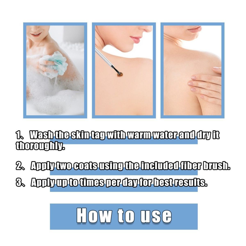 Remover, 24ss skin removal, removal of flesh thorns, flat skin, especially hand foot calluses, and chicken eye ,_voghion.com