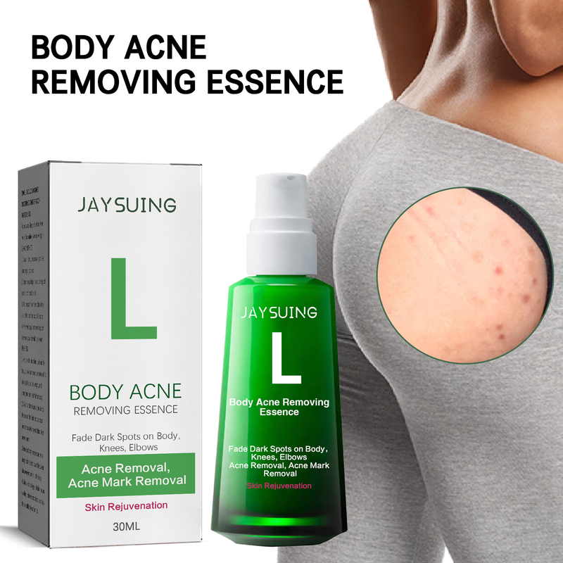 Jayswing Acne Removing&Whitening can lighten spots, acne marks, moisturize and whiten skin essence_voghion.com