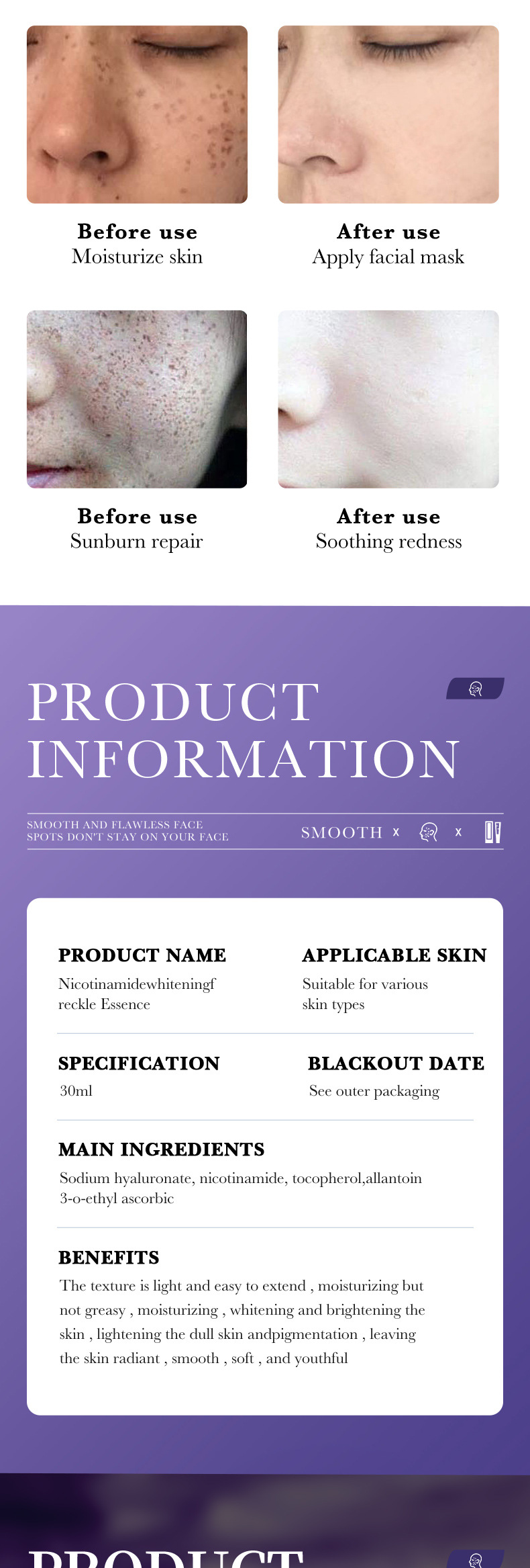 Siero Cross All English Border SADOER Essenza schiarente e rimuovi macchie alla nicotinamide per schiarire il tono della pelle_voghion.com