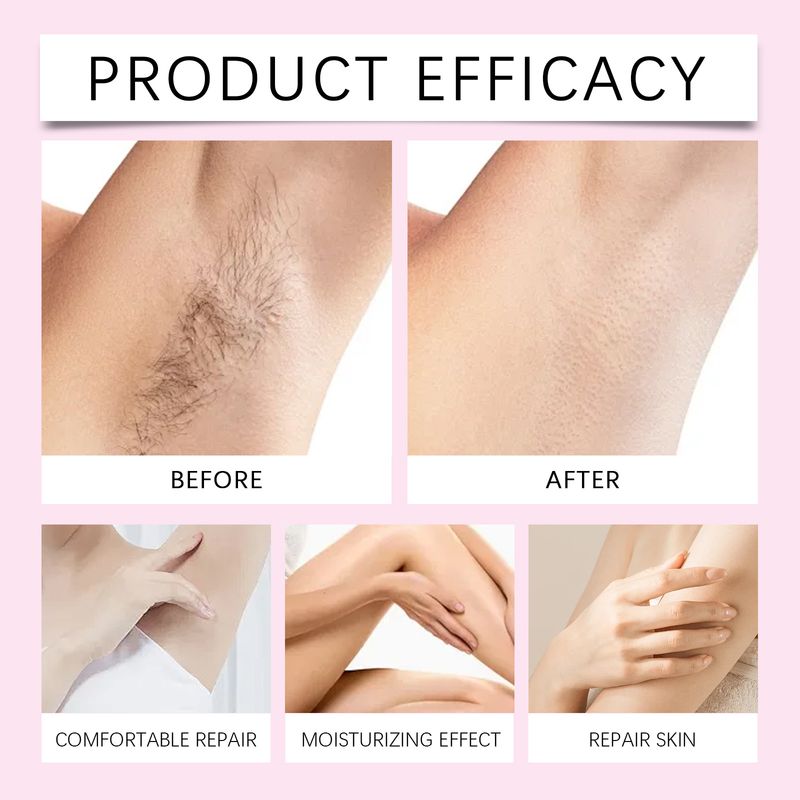 Essenza dopobarba depilatoria Hoygi, idratante delicato per una soluzione delicata e morbida per la cura della pelle._voghion.com
