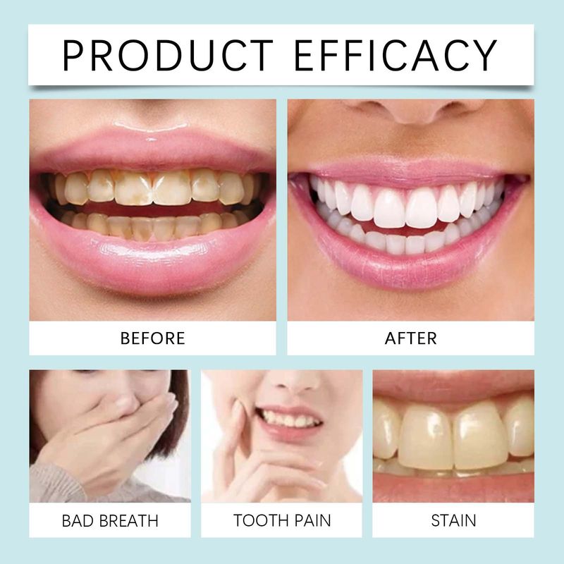 Smacchiatore per denti, pulizia delle macchie e dello sporco dai denti, cura dell'igiene dei denti e della loro naturale luminosità, cura dei denti_voghion.com