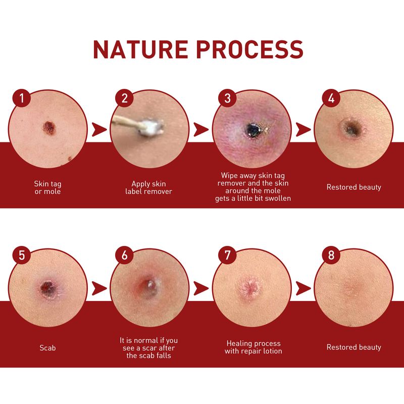 2025 Αντι-ελιές για βαθύ καθαρισμό του δέρματος, εξάλειψη κονδυλωμάτων, αφαλάτωση μαύρων ελιών, επανόρθωση και λείανση_voghion.com