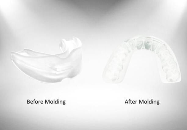 1PC Silikon Nachtschutz für Zähne Zusammenpressen Schleifen Dental Beißen Hilfe Mund Tablett Persönliche Gesundheitspflege Schlaf_voghion.com