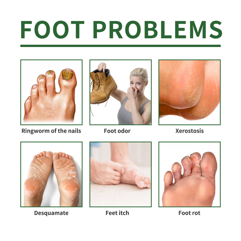 Máscara para os pés Moon South para reparação de unhas Máscara para os pés para reparação de unhas Unhas grisalhas Unhas brilhantes Pés secos e rachados Removendo pele morta_voghion.com