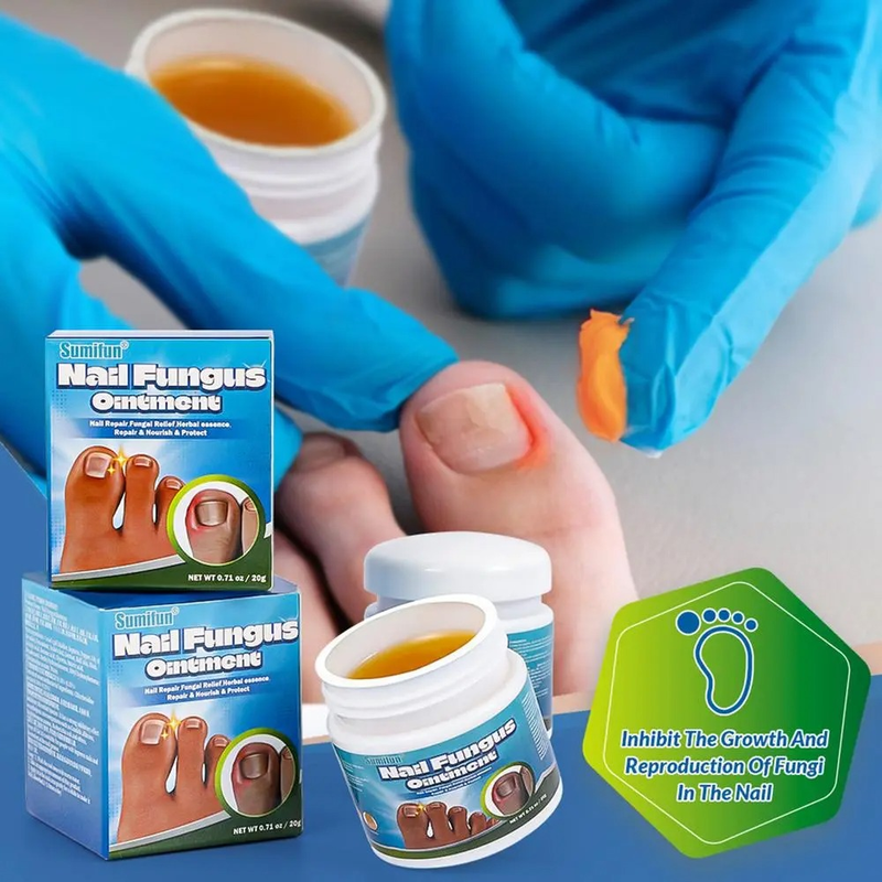 Nagelreparaturserum Salbe Onychomykose Paronychie Nagel Kräuter Zehennagel Fußreparatur Essenz Pflege Reparatur Trockenriss Fußpflege 20g_voghion.com