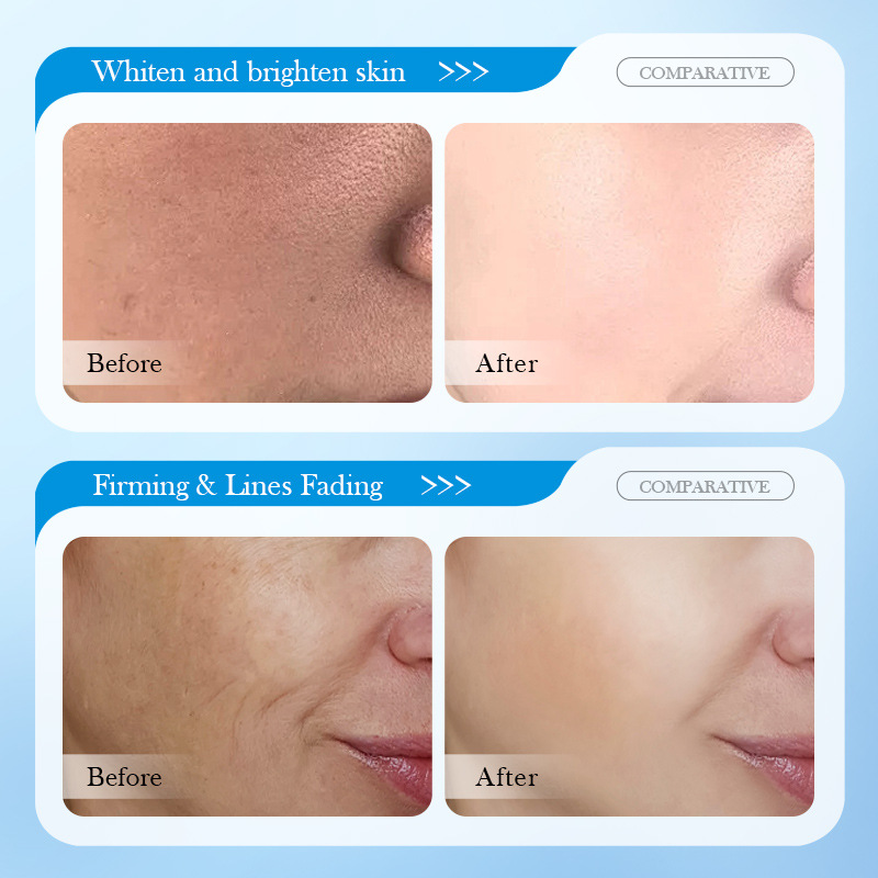 Todos os Inglês SADOER8D Ácido Hialurônico Antirrugas Hidratante e Nutritivo Creme facial Hidratante e Rejuvenescedor_voghion.com
