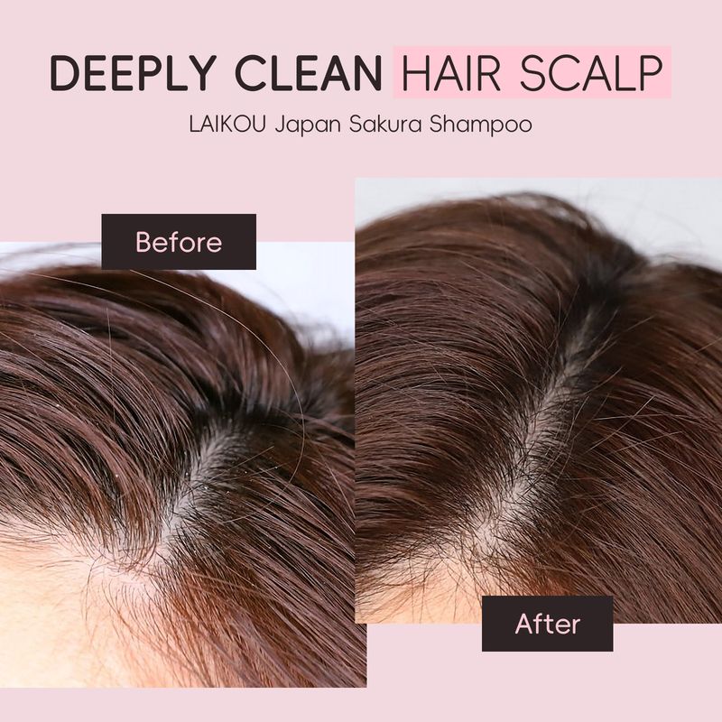 LAIKOU Sakura Shampoo 400ml Grote Fles Reinigt, Verzacht, Houdt Langdurig en Laat Geur Achter_voghion.com