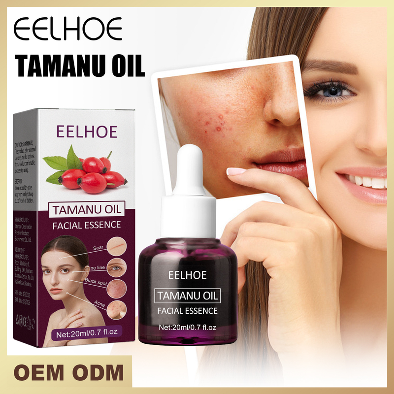 Qiongya Begonia Belle huile essentielle élimine l'acné, ferme la bouche, rétrécit les pores, répare les muscles sensibles et_voghion.com