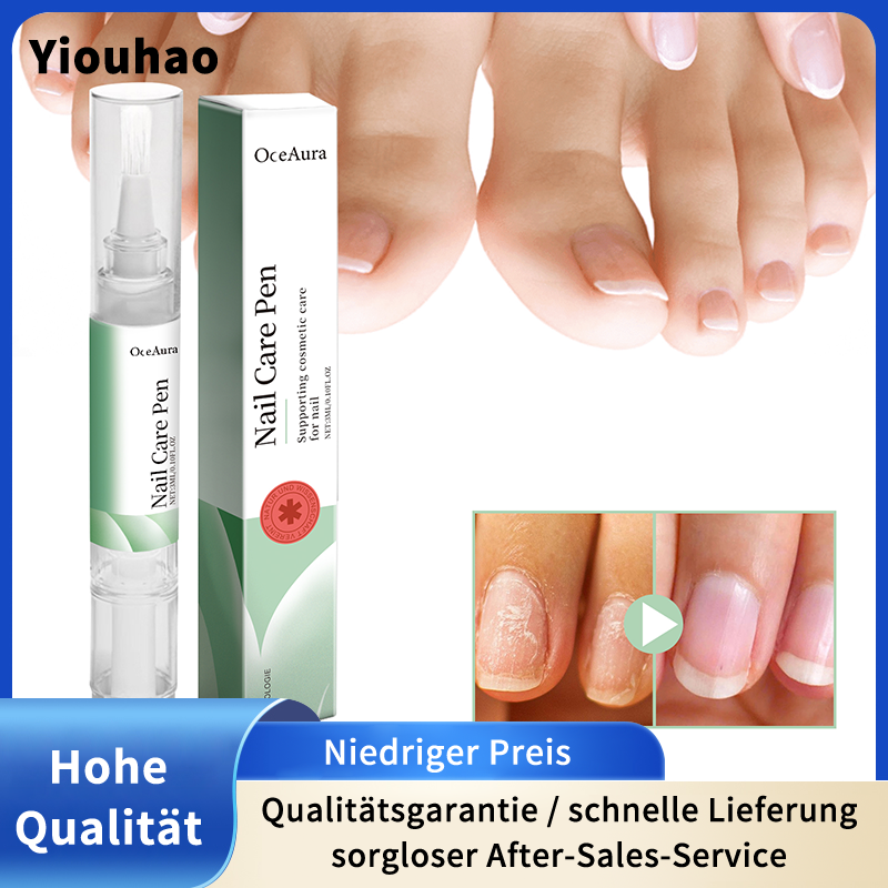 OceAura Nagelpflege Pflücken So Sanft Ab, Dass Er Gegen Risswunden Sauber Wird Und Schwimmbecken Vor Entropie Schützt_voghion.com