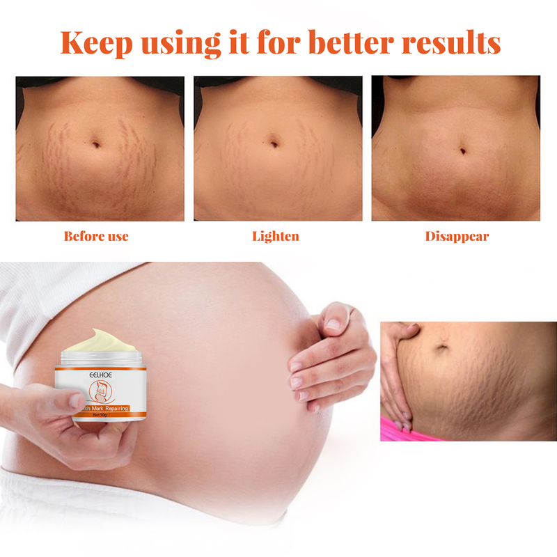 QLZHANFU Crème réparatrice contre les vergetures Crème pour la peau pour les femmes enceintes pour resserrer et desserrer les soins de la peau post-partum pour améliorer les rides_voghion.com