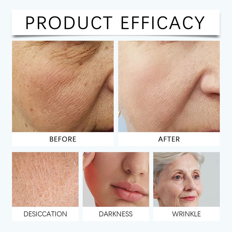 Hoygi Collagen B5 Moisturizing Mask (Box Set) Gently Moisturizes And Hydrates The Facial Skin, Cleanses Pores And Replenishes Moisture_voghion.com