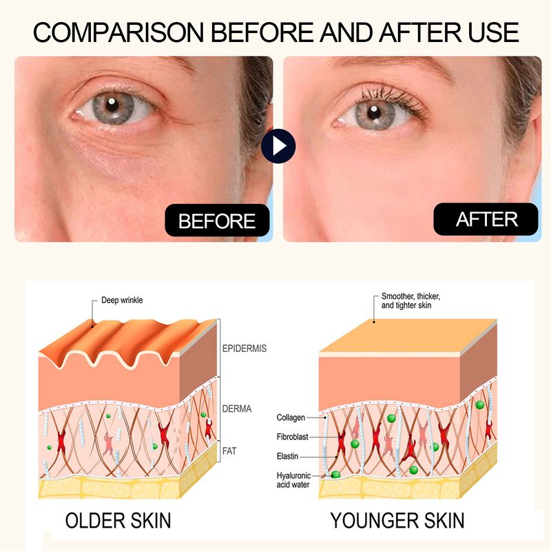 Jaysuing All-In-One Hyaluronsäure-Behandlung, Entsalzungsbeutel, schwarzer Augenrand, Anti-Falten-Straffung, Haun White Skin_voghion.com