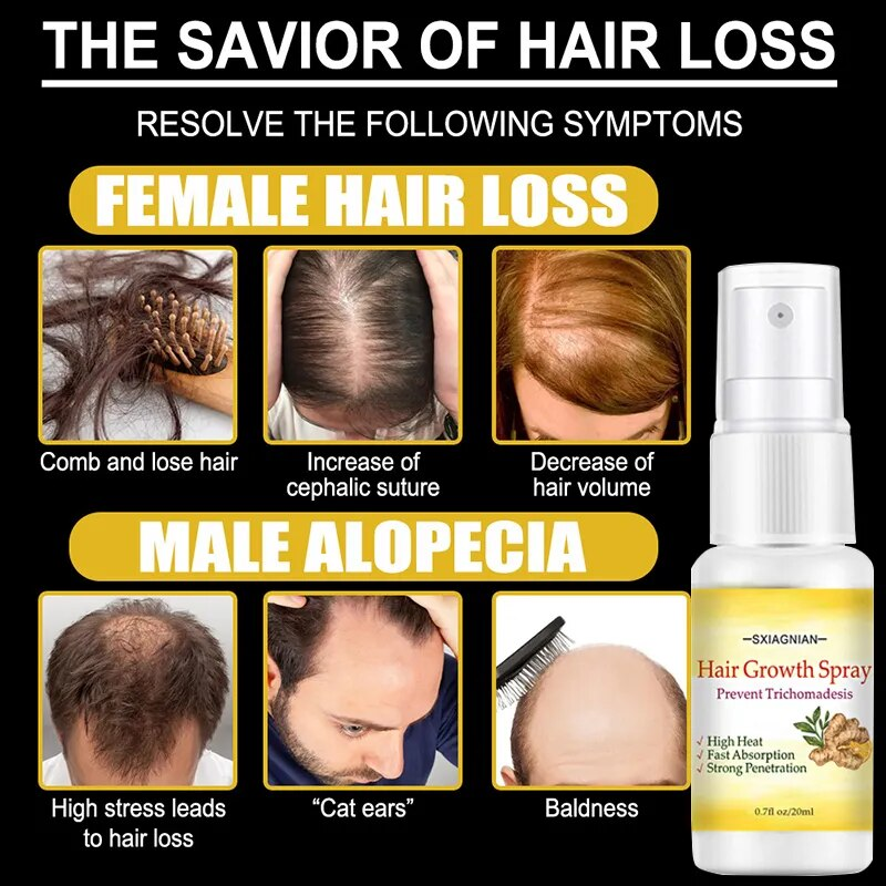 Ginger Fast Hair Growth Serum Spray Regrowth Essence Oil Hiustenlähtöä estävät tuotteet ehkäisevät kaljuuntumista Päänahan hoito Kauneus terveys_voghion.com