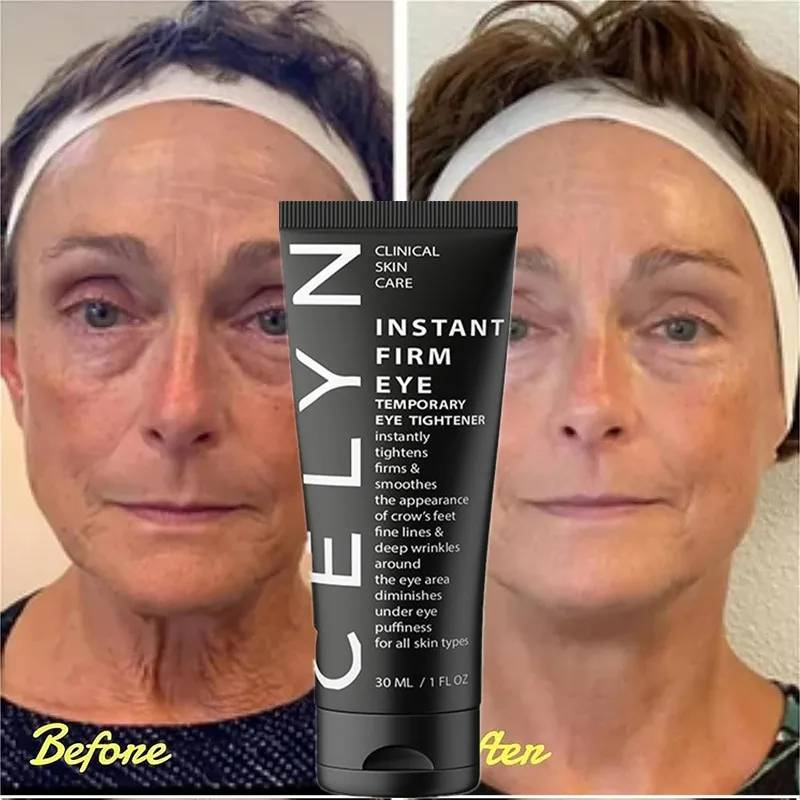 30ml Instant Firm Eye Cream Reduz linhas finas e olheiras ao redor dos olhos Levanta a pele Remove bolsas nos olhos Firmador de olhos_voghion.com