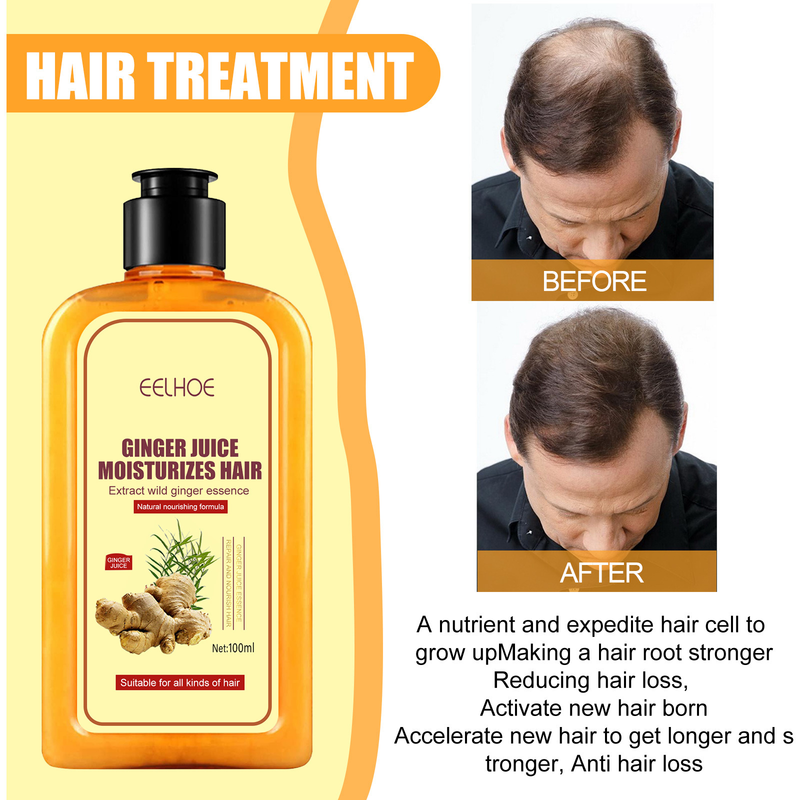 EELHOE Shampoo nutriente forte per le radici allo zenzero, ripara la caduta dei capelli e fissa lo shampoo_voghion.com