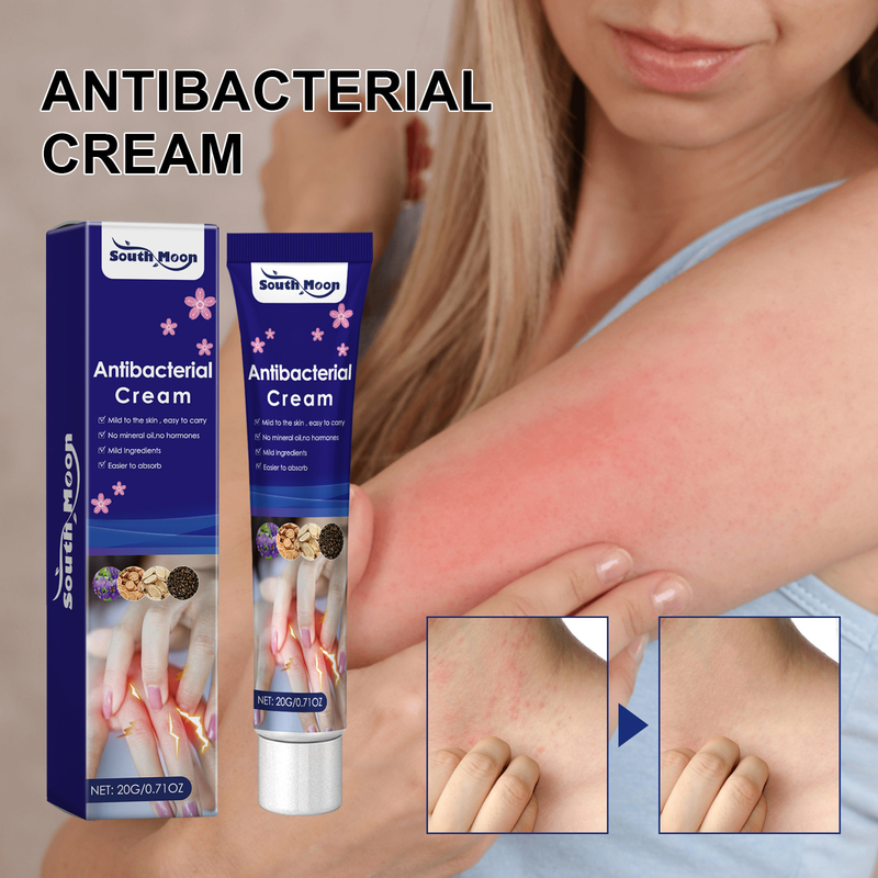 South Moon Zihua Di Ding Skin Antipruritus Tørr hud, kløe, rødhetslindrende fuktighetsgivende pleiekrem_voghion.com