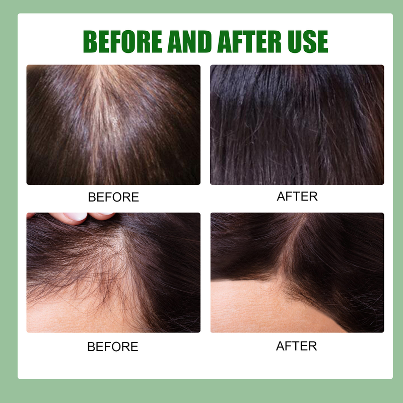 Hår Vacker ingefära tillväxt essens Närande Hårvård Hårrotsvård spray Tough Repair Growth Flytande_voghion.com