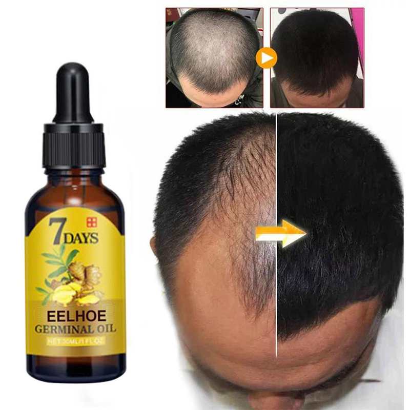 Growth Serum Oil 10/20/40Ml Tät regenerering Ginger Hårvård Reparation Vätska Essential Anti Loss_voghion.com