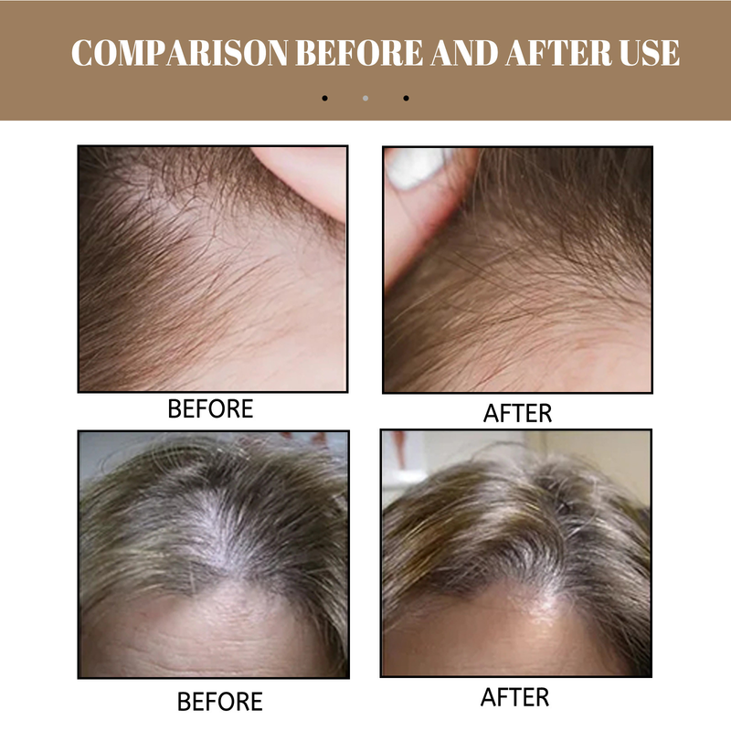 EELHOE Rice Anti Drop Shampoo für dichtes, festigendes, reinigendes, wurzelndes, nährendes und schützendes Haar_voghion.com