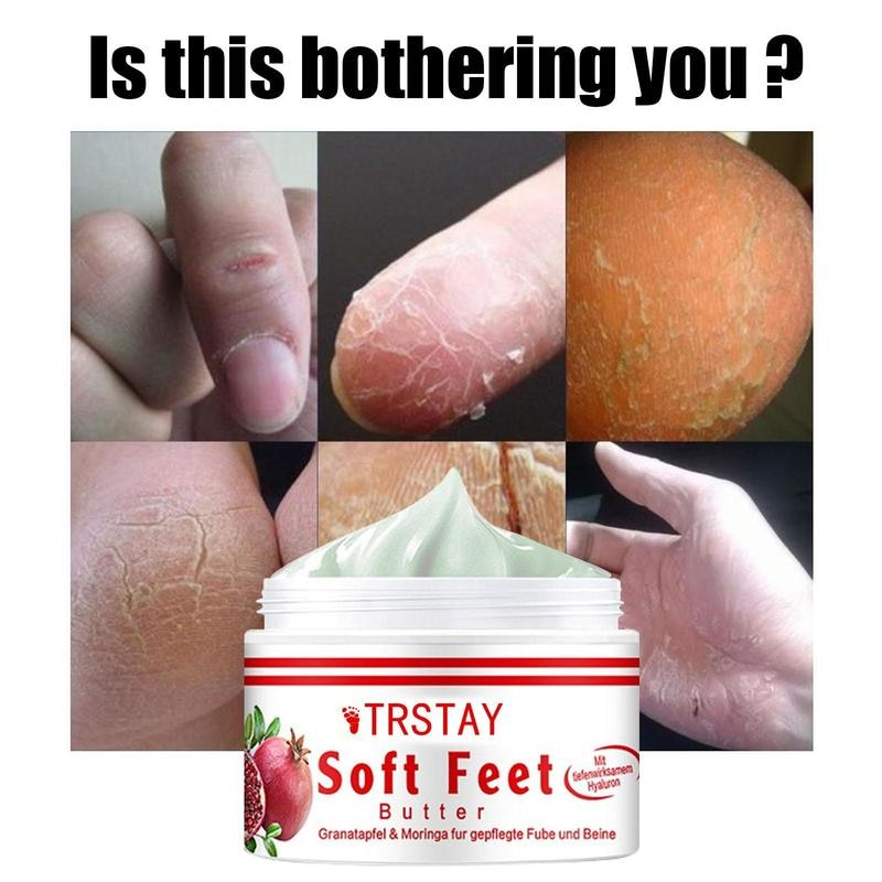 Anticongelante antigrietas y crema para pies hidratante reparadora de la piel seca, antipeeling manos ásperas y agrietadas pies Hs_voghion.com