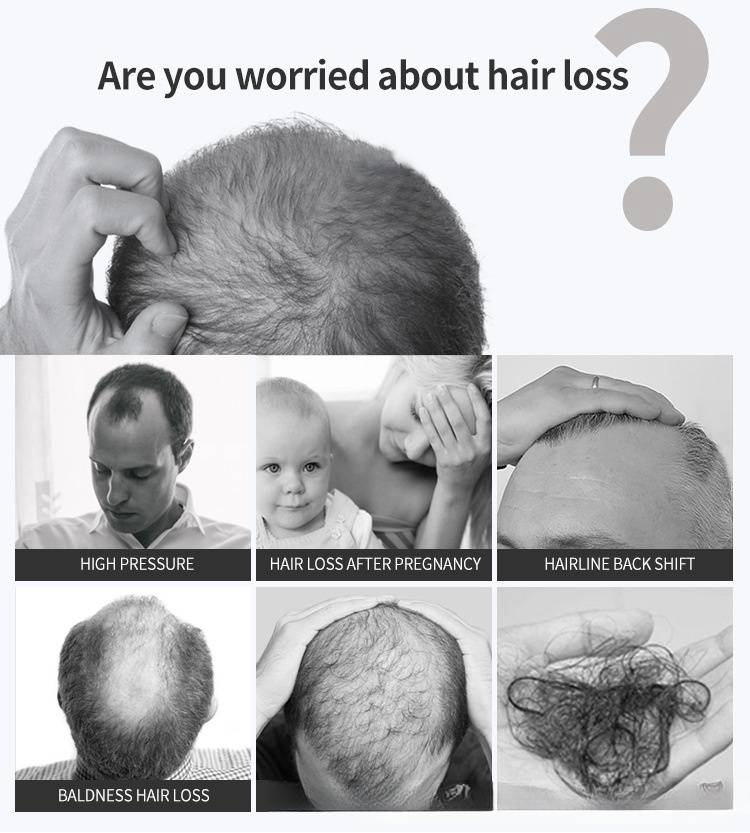 20 ml Haarwuchsserum, Biotin-Haarwuchsspray, Haarwuchsserum für dickeres, längeres und kräftigeres Haar_voghion.com