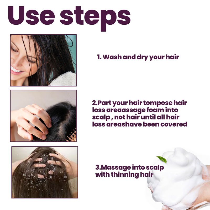 EELHOE foam growth care, strong anti dropping, stimulating follicle, long hair, nutrition and hair fixation_voghion.com
