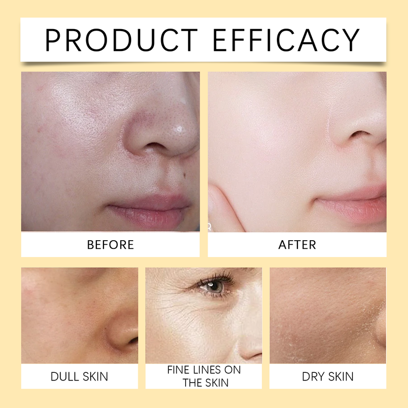 Hoygi Vitamin C Cream Gentle Facial Moisturizing And Moisturizing Skin Moisturizing Cream_voghion.com