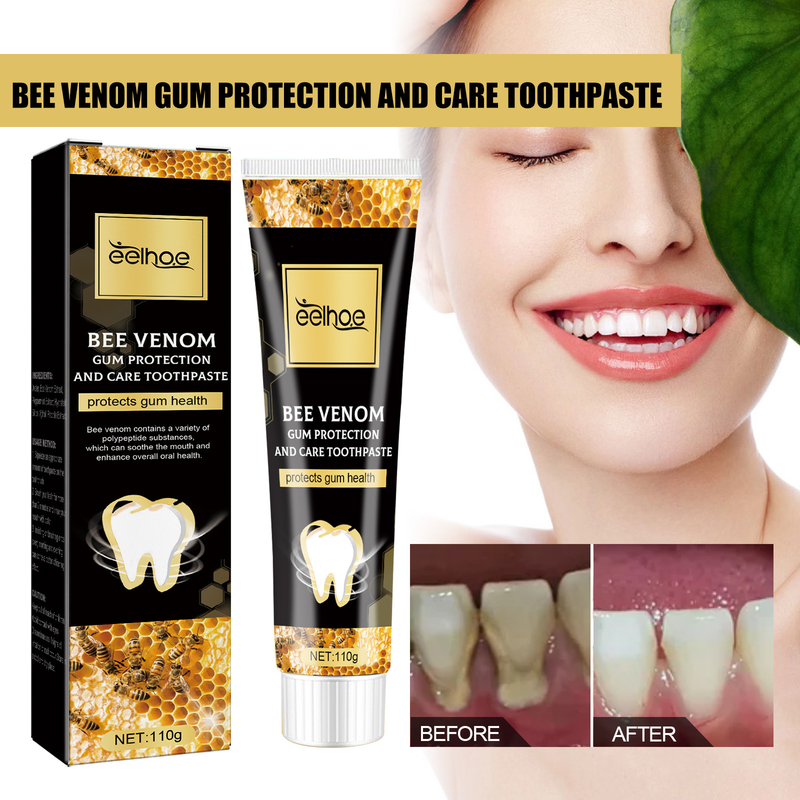 EELHOE Bee Venom Gingival Protection for Deep Cleaning of Dental Stains, Oral Odors, Fresh Breath, Whitening T_voghion.com
