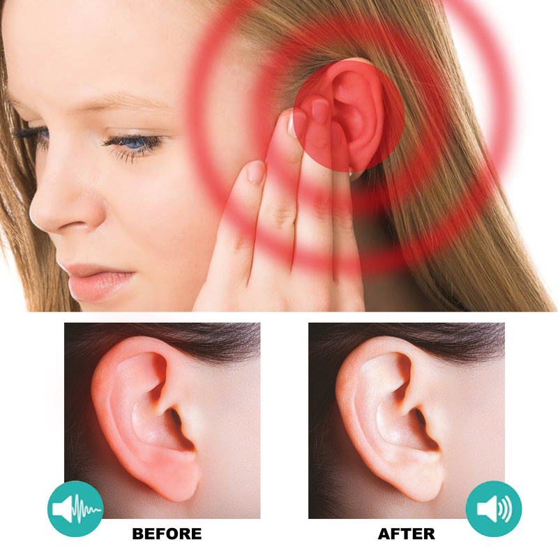 EELHOE Tinnitus Discomforts, Ear Health Alleviates Head Care Acupoint Patch_voghion.com