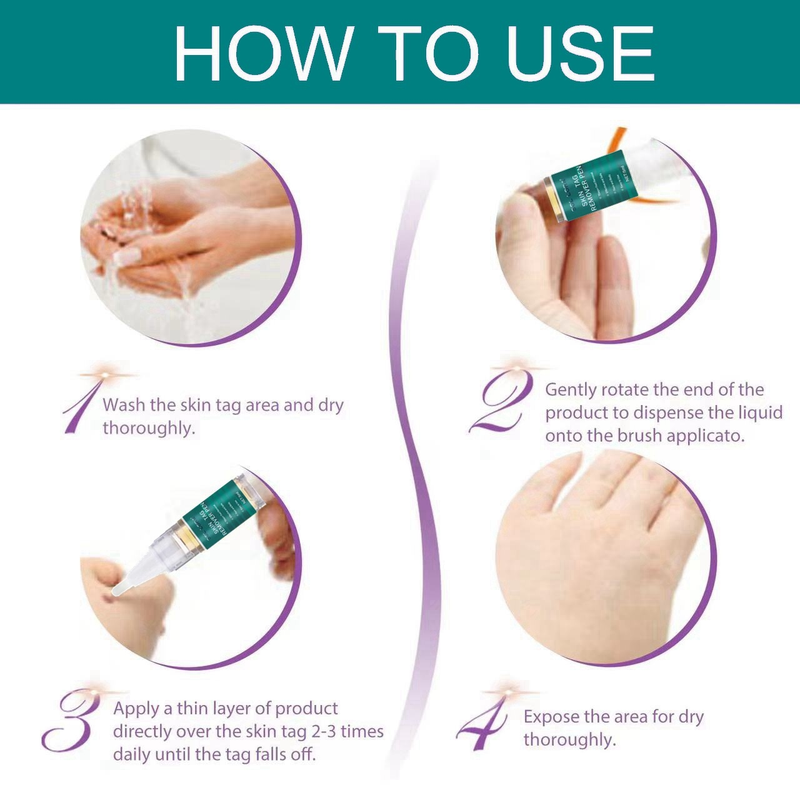 SOL LORA Pen Cream flat specially sharp Ke warts, You Ping Liquid for removing warts_voghion.com