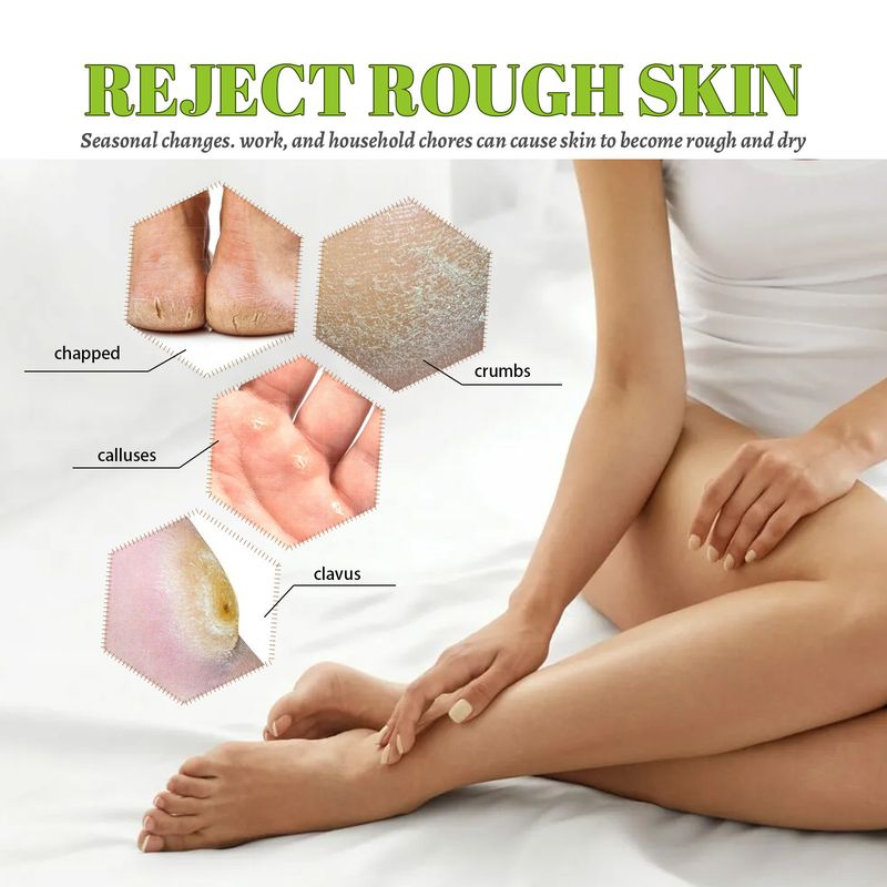Crema para el cuidado de los pies South Moon Hidrata, previene la sequedad, el agrietamiento, la descamación y el agrietamiento en el talón, humectando e hidratando._voghion.com