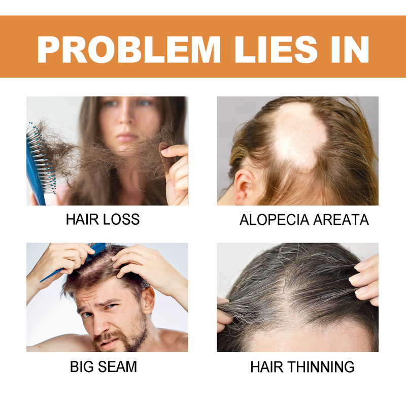 Dense Hair Beautiful Anping Bottle, Strong and Tough, Repairing and Preventing Hair Loss, Root Fixing and Thick Hair C_voghion.com