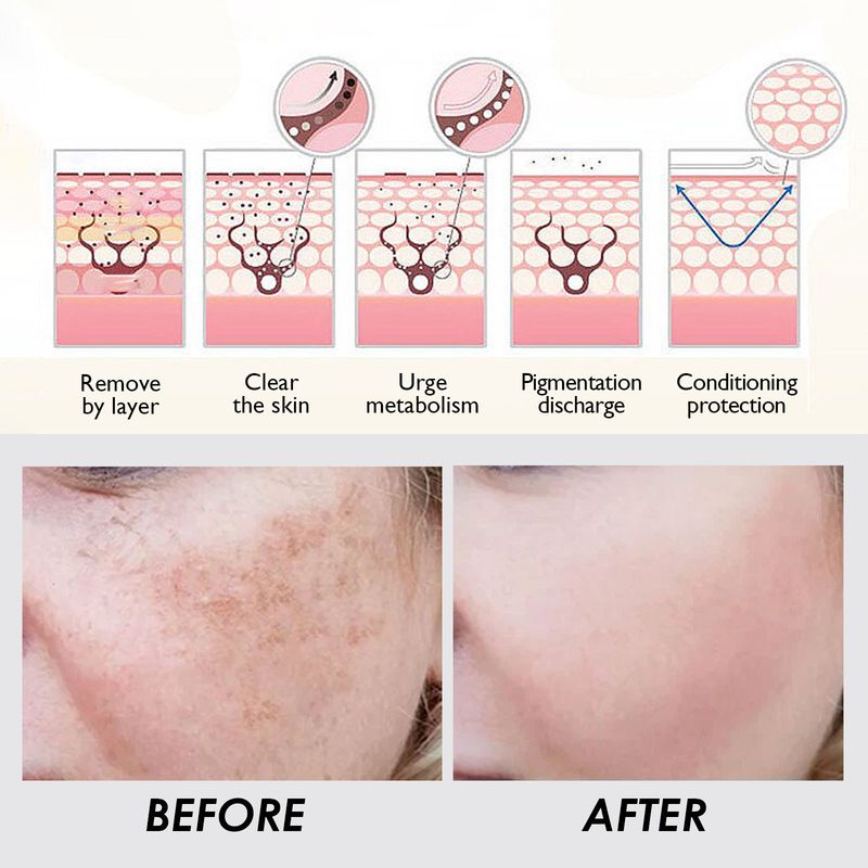 EELHOE Nicotinamide Brightening Spot Capsule desalinates spots, moisturizes, tightens and whitens skin essence_voghion.com