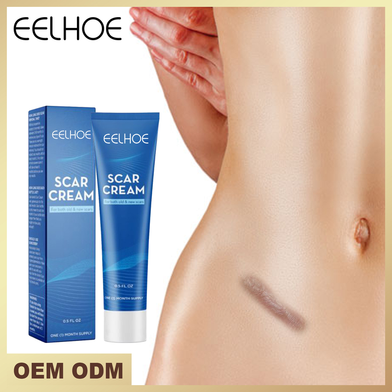 Repair Skin for Scalds, Burns, Acne Marks, Fading and Smoothing Care Scar Cream_voghion.com