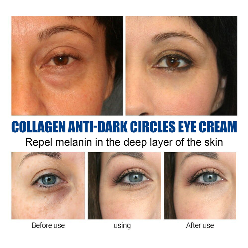 Eye Beautiful Collagen Cream for Removing Black Circles and Diminishing Bags and Fine Lines under the Eyes, Panda _voghion.com