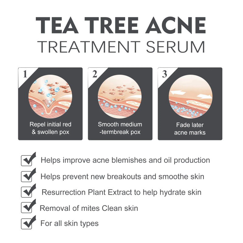 Akne-Behandlungsserum. Gewöhnliche Salicylsäure-Seren entfernen Pickel, Mitesser, Anti-Akne-Poren, schrumpfen die Hautverjüngungsessenz_voghion.com