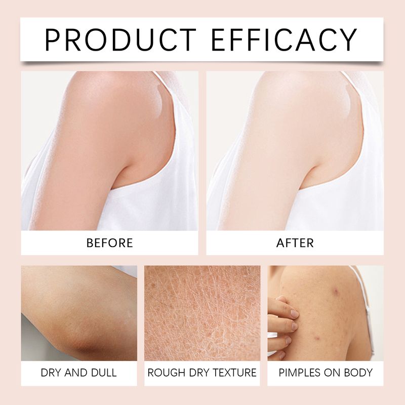 WoodSleep Frankincense Body Butter Moisturizer Moisturizes All Over The Skin With Silky, Creamy Touch_voghion.com