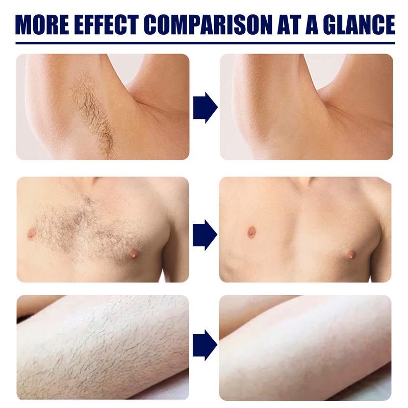 Gentle non irritating cream chest armpit removal, smooth leg for men's whole body removal and hair suppression 2024 popular_voghion.com