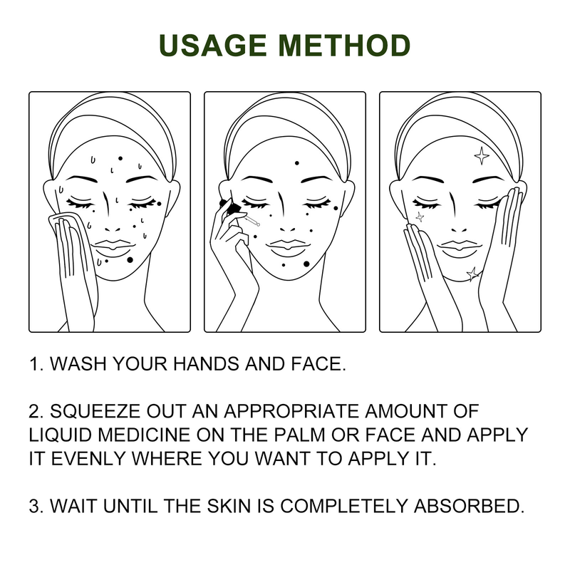 OUHOE Nevus Giderici Losyon Nevus Giderici Krem Siyah Noktaları Onarıcı ve Giderici Nevus Giderici Gül_voghion.com