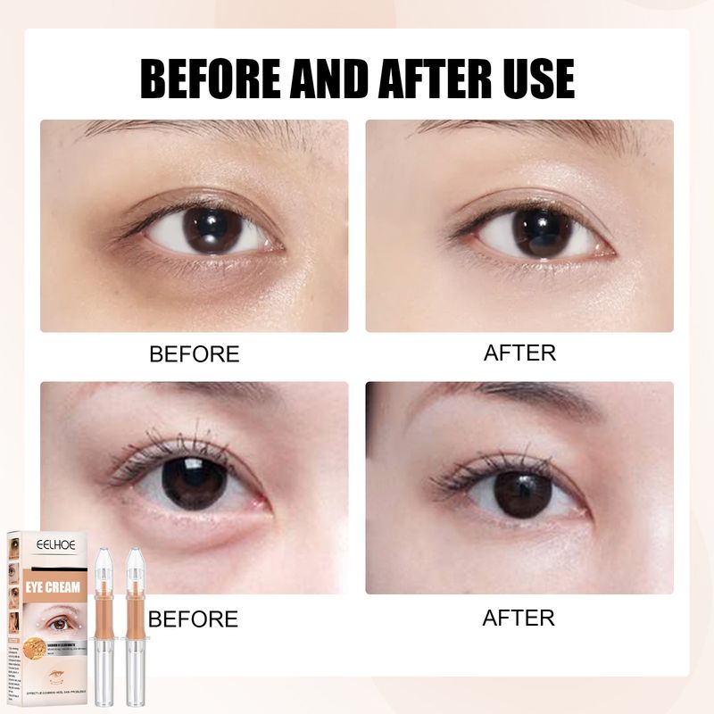 Crema para ojos EELHOE Reafirma y debilita las líneas finas alrededor de los ojos Círculos negros Crema para ojos con esencia hidratante y rejuvenecedora_voghion.com