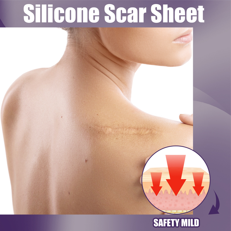 EELHOE silikone til at lette graviditet kejsersnit kirurgisk hyperplasi ar reparation plaster_voghion.com