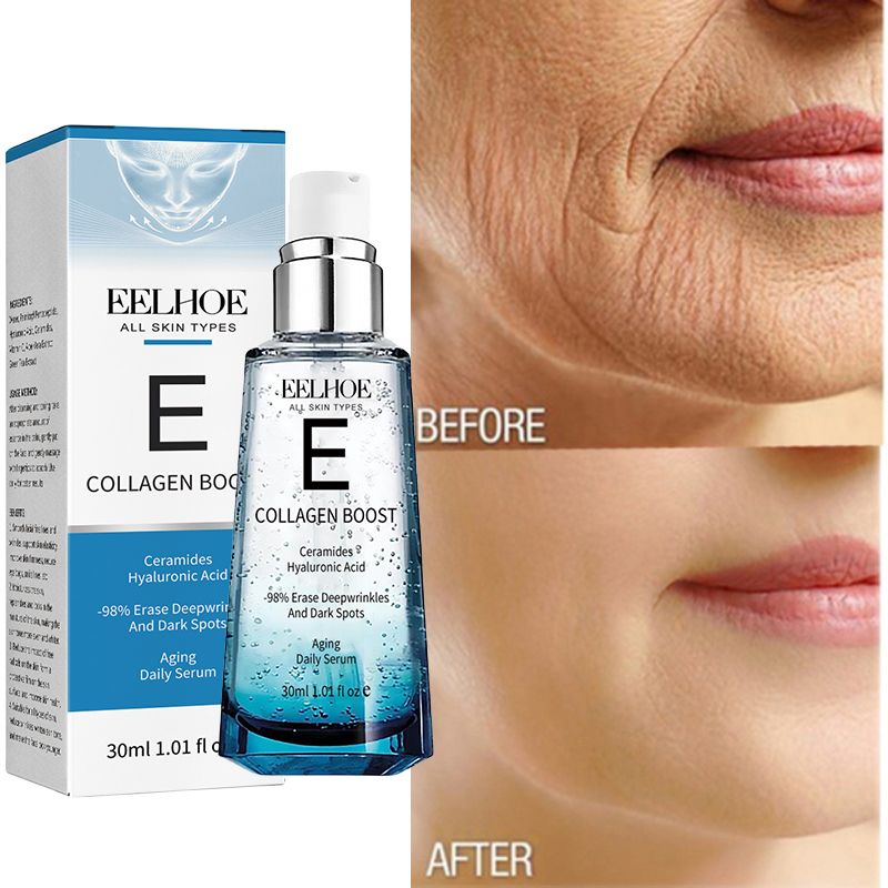 Siero viso Collagen Boost, rimozione macchie scure, rughe, anti-invecchiamento, lifting per occhi, idratante, prodotti per la cura della pelle coreana, 30 ml_voghion.com