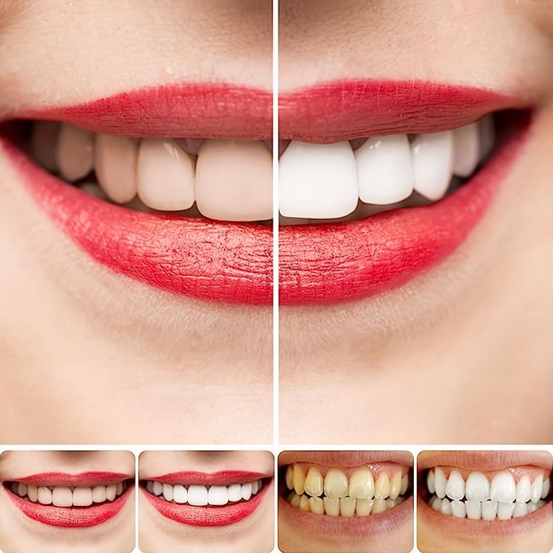 Watermelon Mint Flavor Toothpaste Suitable For Teeth Whitening And Care, Same As Baking Soda_voghion.com