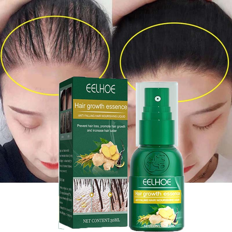 Ingwer-Haarwuchsspray-Produkte, natürliches Anti-Haarausfall-Serum, verhindern Haarausfall, Behandlung, schnelles Wachstum, nähren geschädigtes Haar_voghion.com