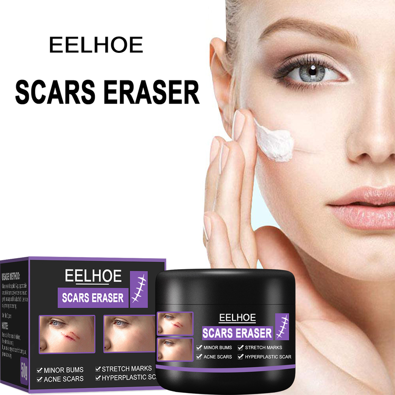 EELHOE Narbe zur Aufhellung postoperativer Narben, zur Glättung der Haut, zur Reparatur und Befeuchtung der Hautpflegecreme_voghion.com