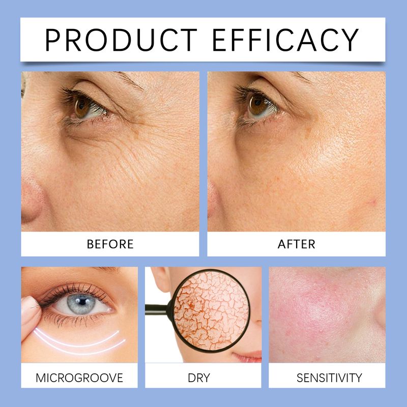 Hoygi Retinol Cream Hydrates, Moisturizes And Nourishes Facial Skin, Reduces Fine Lines, Improves Skin Quality And Firming Face Cream_voghion.com